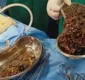 
                  Médicos retiram R$250 mil em joias do estômago de paciente