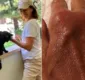 
                  Daniela Escobar quase amputa a mão após mordida de gato