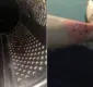 
                  Homem usa ralador de queijo para remover tatuagem