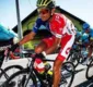 
                  Ciclista afastado por doping posta foto chocante de perna