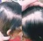 
                  Mulher acusa madrasta de ferir e arrancar cabelos da filha