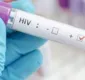 
                  Novo subtipo do vírus HIV é identificado por cientistas