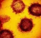 
                  Novo teste confirma primeiro caso de coronavírus no Brasil