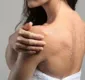 
                  Para ficar radiante: veja dicas para fazer esfoliação na pele