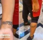 
                  Fã faz tatuagens com nome de Anitta no braço e na perna