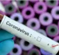 
                  Saiba tudo sobre o novo coronavírus e a doença que ele provoca