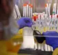 
                  Anvisa aprova testes rápidos para covid-19 em farmácias