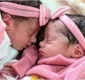 
                  Recém-nascidas gêmeas são mortas por cachorro da família na Bahia