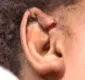 
                  Mulher quase tem orelha arrancada durante agressões do namorado