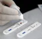 
                  Sete drogarias têm autorização para testes rápidos de Covid-19