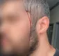 
                  Sobrinho de Bolsonaro é acusado de tentar matar namorado da ex