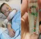 
                  Criança é operada às pressas após engolir 19 ímãs de brinquedo