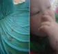 
                  Bebê é atacado por rato gigante enquanto dormia
