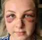 
                  Adolescente espanca policial para evitar prisão: 'nariz pendurado