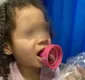 
                  Criança passa por cirurgia após ficar com a língua presa