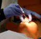 
                  Faculdade oferece 150 vagas para atendimento odontológico