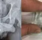 
                  Homem é levado às pressas ao hospital após inserir pilha no pênis