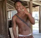 
                  Ex-participante de 'A Ilha', tem suposto nude vazado e web: 'Tatuagem entrega'