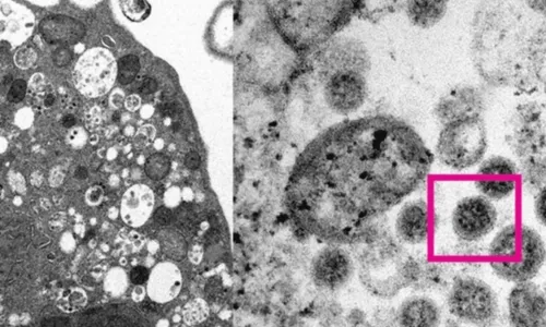 
				
					Ômicron: novas sublinhagens podem driblar a imunidade das infecções passadas, diz estudo
				
				