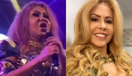 
				
					Sequela da Covid-19? Entenda o que pode ter causado o inchaço no rosto de Joelma
				
				