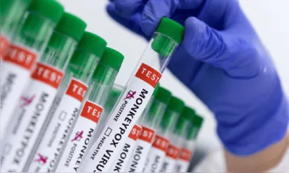 
		Casos de varíola dos macacos chegam a 76 em todo o país