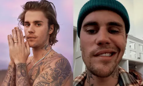 
				
					Justin Bieber preocupa fãs ao aparecer com rosto paralisado; veja vídeo
				
				