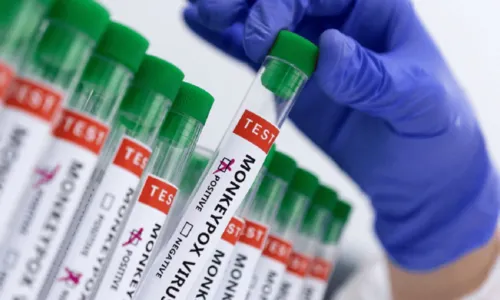 
				
					Secretaria de Saúde confirma primeiro caso de varíola dos macacos no interior da Bahia
				
				