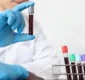 
                  Bahia confirma dois novos casos de varíola dos macacos; total de infectados chega a 68