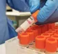 
                  Caso suspeito da varíola do macaco na Bahia é descartado após testes laboratoriais