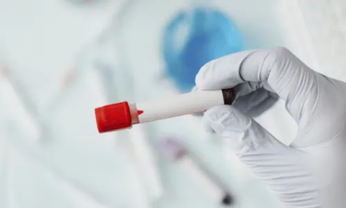 
				
					Paciente é declarado curado do HIV após receber células-tronco
				
				