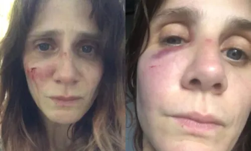 
				
					Atriz francesa denuncia ter sofrido violência doméstica cometida pelo pai da filha dela e desabafa: 'Não aguento mais'
				
				