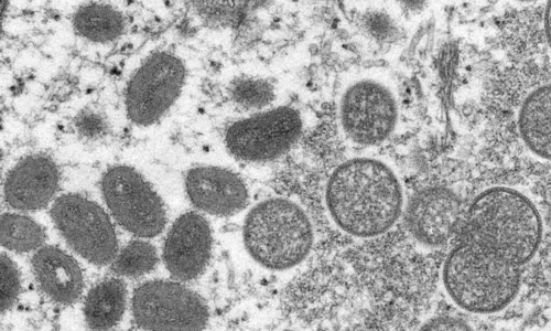 
				
					Segundo caso da varíola dos macacos é registrado na Bahia
				
				