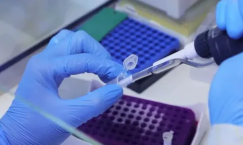 
				
					Fiocruz pede registro de dois testes moleculares para monkeypox
				
				