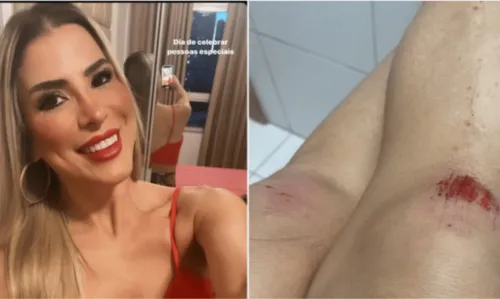 
				
					Ex-BBB Milena Fagundes diz que foi hostilizada com latas e empurrões em festa do Caprichoso
				
				