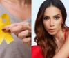 O que é endometriose? Saiba o que, quais os sintomas e como tratar doença revelada por Anitta