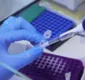 
                  Brasil ganha material biológico para vacina contra varíola dos macacos