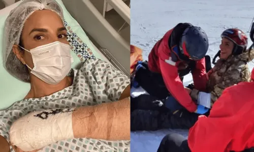 
				
					Após passar por cirurgia, Ivete Sangalo mostra vídeo de acidente esquiando: 'Dor insuportável'
				
				