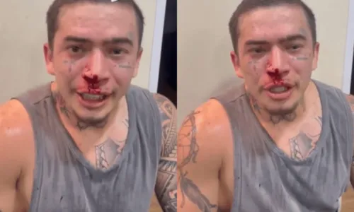 
				
					Whindersson Nunes machuca o rosto durante treino de MMA: 'Mexi com o cara errado'
				
				