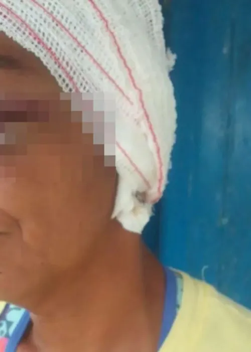 
				
					Mulher é agredida e tem a orelha arrancada pelo filho e nora em Pedrão, a 120km de Salvador
				
				