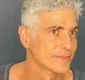 
                  Eternamente galã: Reynaldo Gianecchini passa por procedimento de rejuvenescimento facial aos 49 anos