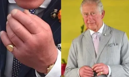 
		'Dedos de salsicha': saiba o que pode causar e os riscos do inchaço nas mãos do rei Charles III