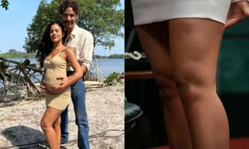 
				
					Bella Campos, a Muda de 'Pantanal', sofre ataque de jacaré e fica com cicatriz na perna
				
				