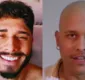 
                  Participante de reality da MTV Brasil revela luta contra câncer agressivo e pede doações de medula