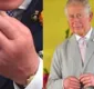 
                  'Dedos de salsicha': saiba o que pode causar e os riscos do inchaço nas mãos do rei Charles III