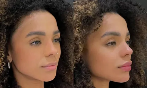
				
					Brunna Gonçalves passa por novo procedimento no rosto; confira antes e depois
				
				