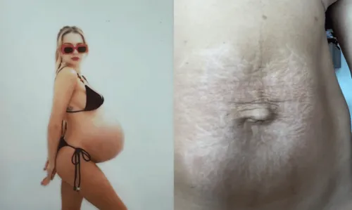 
				
					Isabella Scherer mostra barriga pós-parto dos gêmeos Mel e Bento
				
				