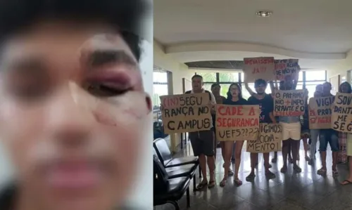 
				
					Estudante denuncia nove seguranças da Uefs por agressão
				
				