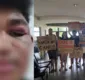 
                  Uefs afasta cinco vigilantes após estudante relatar agressão no campus