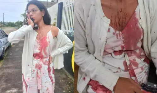 
				
					Vídeo mostra momento em que mulher levanta e se aproxima de jovem que teve rosto cortado em ônibus
				
				