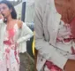 
                  Vídeo mostra momento em que mulher levanta e se aproxima de jovem que teve rosto cortado em ônibus